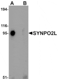 Western blot - SYNPO2L Antibody from Signalway Antibody (25219) - Antibodies.com