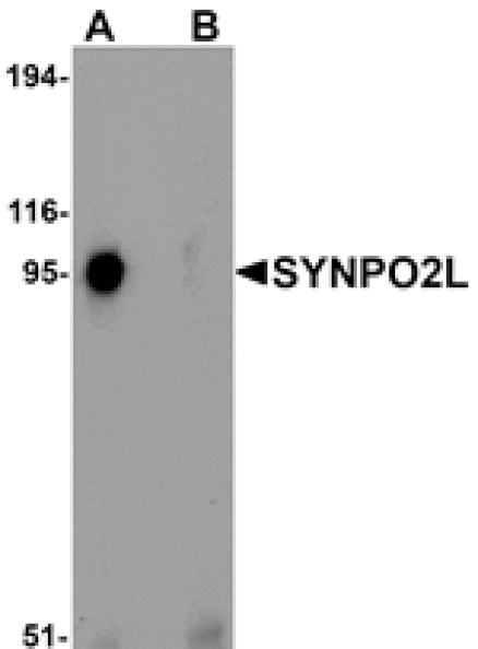 Western blot - SYNPO2L Antibody from Signalway Antibody (25219) - Antibodies.com
