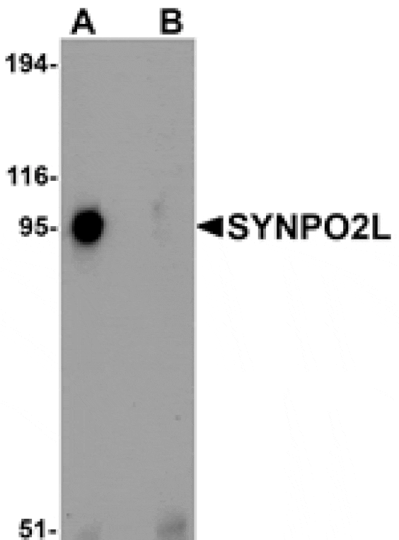 Western blot - SYNPO2L Antibody from Signalway Antibody (25219) - Antibodies.com