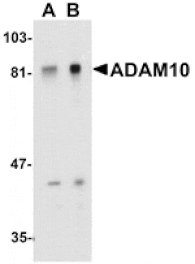 Western blot - ADAM10 Antibody from Signalway Antibody (24044) - Antibodies.com
