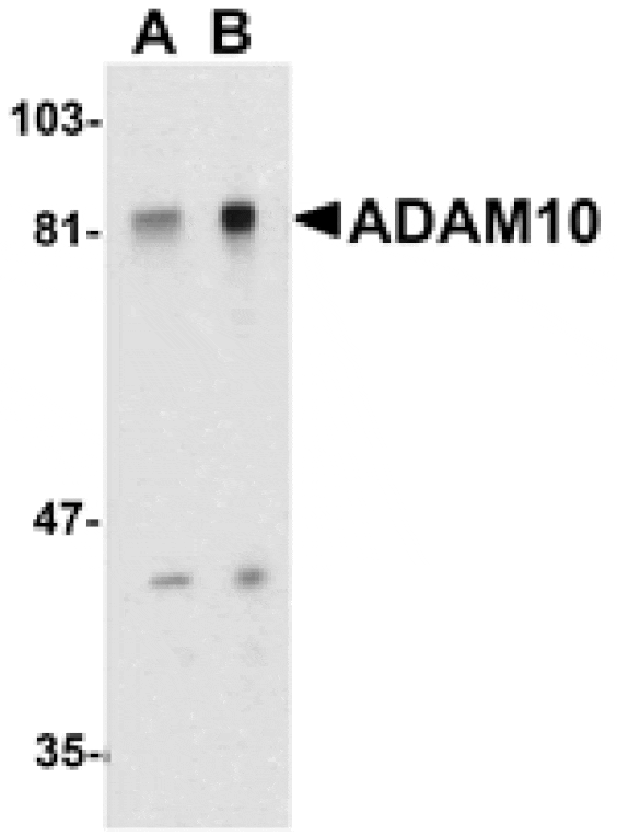 Western blot - ADAM10 Antibody from Signalway Antibody (24044) - Antibodies.com