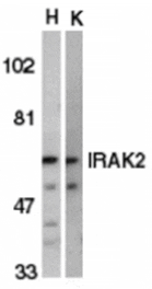 Western blot - IRAK-2 Antibody from Signalway Antibody (24064) - Antibodies.com