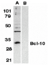 Western blot - Bcl-10 Antibody from Signalway Antibody (24078) - Antibodies.com