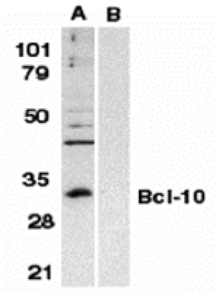 Western blot - Bcl-10 Antibody from Signalway Antibody (24078) - Antibodies.com