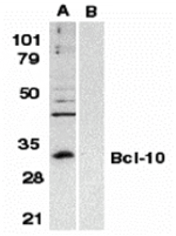 Western blot - Bcl-10 Antibody from Signalway Antibody (24078) - Antibodies.com