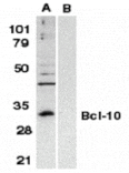 Western blot - Bcl-10 Antibody from Signalway Antibody (24078) - Antibodies.com