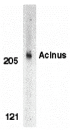 Western blot - Acinus Antibody from Signalway Antibody (24085) - Antibodies.com