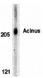 Western blot - Acinus Antibody from Signalway Antibody (24086) - Antibodies.com