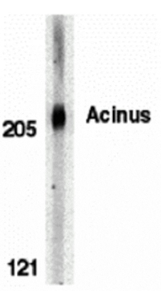 Western blot - Acinus Antibody from Signalway Antibody (24086) - Antibodies.com