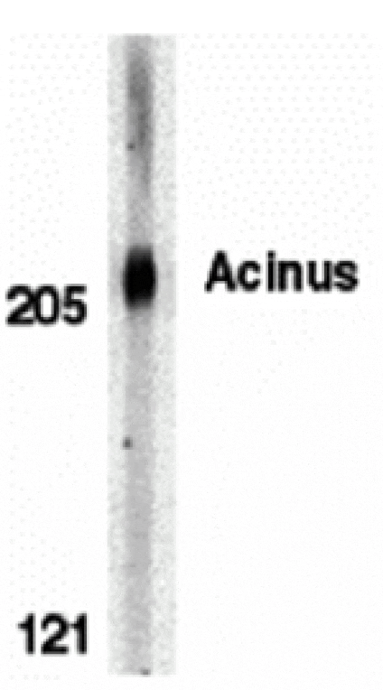 Western blot - Acinus Antibody from Signalway Antibody (24086) - Antibodies.com