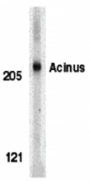 Western blot - Acinus Antibody from Signalway Antibody (24087) - Antibodies.com