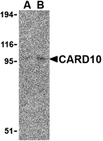 Western blot analysis of CARD10 expression in EL4 cell lysate with CARD10 antibody at (A) 5 and (B) 10 µg /ml.