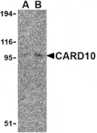 Western blot - CARD10 Antibody from Signalway Antibody (24164) - Antibodies.com