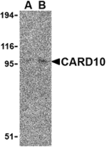 Western blot - CARD10 Antibody from Signalway Antibody (24164) - Antibodies.com