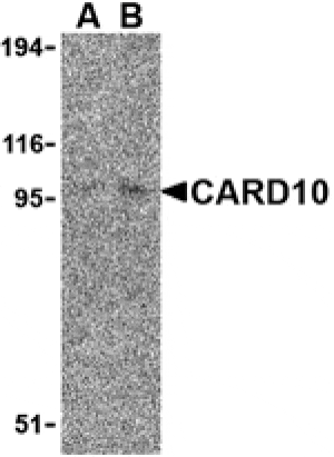 Western blot - CARD10 Antibody from Signalway Antibody (24164) - Antibodies.com