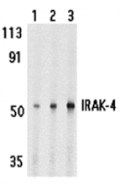 Western blot - IRAK-4 Antibody from Signalway Antibody (24190) - Antibodies.com