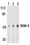 Western blot - IRAK-4 Antibody from Signalway Antibody (24190) - Antibodies.com