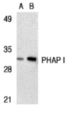 Western blot - PHAP I Antibody from Signalway Antibody (24195) - Antibodies.com