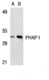 Western blot - PHAP I Antibody from Signalway Antibody (24195) - Antibodies.com