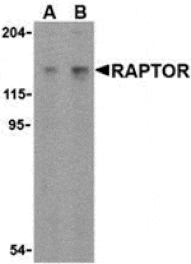 Western blot - Raptor Antibody from Signalway Antibody (24302) - Antibodies.com