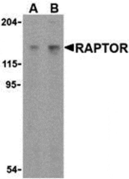 Western blot - Raptor Antibody from Signalway Antibody (24302) - Antibodies.com