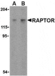 Western blot - Raptor Antibody from Signalway Antibody (24302) - Antibodies.com