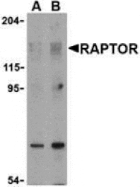 Western blot - Raptor Antibody from Signalway Antibody (24303) - Antibodies.com
