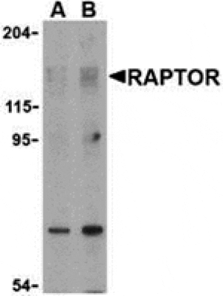 Western blot - Raptor Antibody from Signalway Antibody (24303) - Antibodies.com