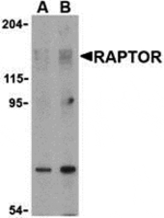 Western blot - Raptor Antibody from Signalway Antibody (24303) - Antibodies.com