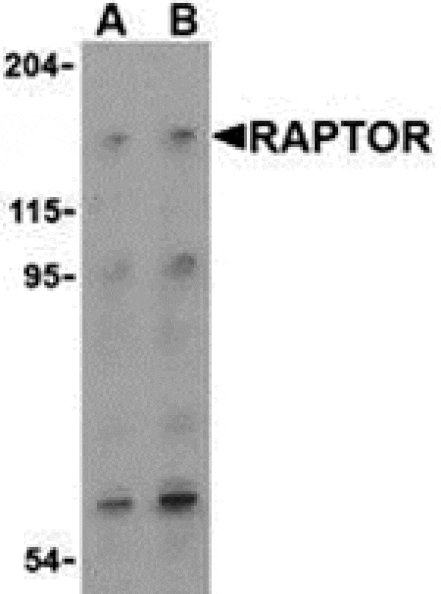 Western blot - Raptor Antibody from Signalway Antibody (24304) - Antibodies.com