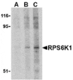 Western blot - RPS6K1 Antibody from Signalway Antibody (24312) - Antibodies.com