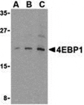 Western blot - 4E-BP1 Antibody from Signalway Antibody (24313) - Antibodies.com