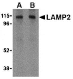 Western blot - LAMP-2 Antibody from Signalway Antibody (24357) - Antibodies.com