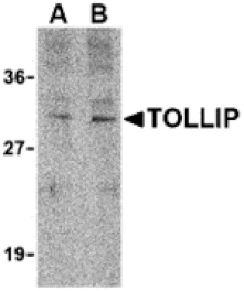 Western blot - TOLLIP Antibody from Signalway Antibody (24388) - Antibodies.com