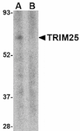 Western blot - TRIM25 Antibody from Signalway Antibody (24571) - Antibodies.com