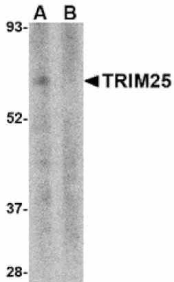 Western blot - TRIM25 Antibody from Signalway Antibody (24571) - Antibodies.com