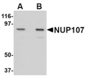 Western blot - NUP107 Antibody from Signalway Antibody (24721) - Antibodies.com