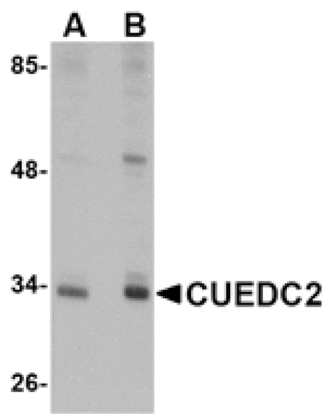 Western blot - CUEDC2 Antibody from Signalway Antibody (24771) - Antibodies.com