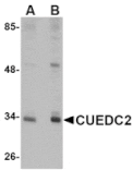 Western blot - CUEDC2 Antibody from Signalway Antibody (24771) - Antibodies.com