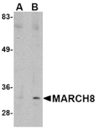 Western blot - MARCH8 Antibody from Signalway Antibody (24788) - Antibodies.com