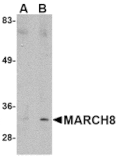 Western blot - MARCH8 Antibody from Signalway Antibody (24788) - Antibodies.com