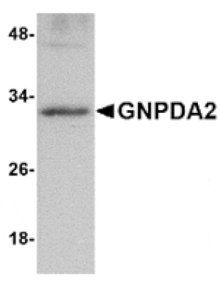 Western blot - GNPDA2 Antibody from Signalway Antibody (24849) - Antibodies.com