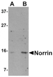 Western blot - Norrin Antibody from Signalway Antibody (24872) - Antibodies.com