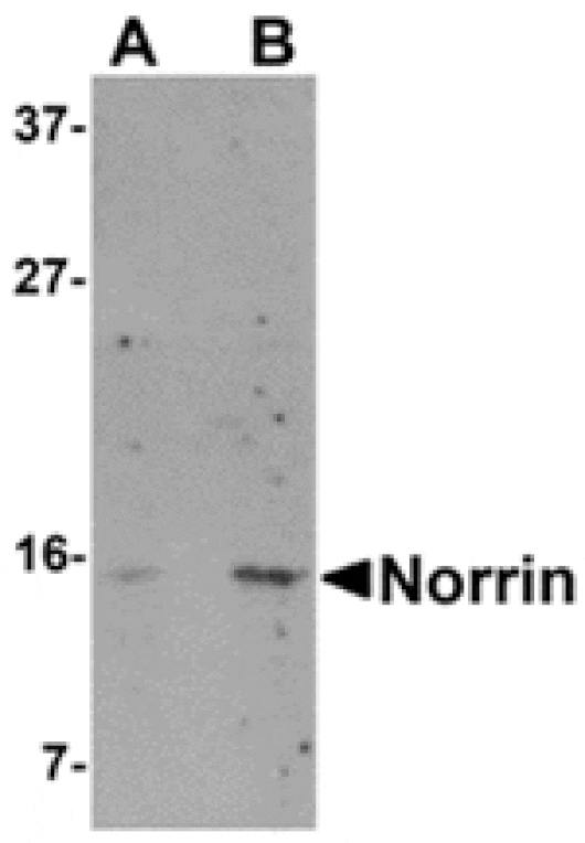 Western blot - Norrin Antibody from Signalway Antibody (24872) - Antibodies.com