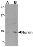 Western blot - Norrin Antibody from Signalway Antibody (24872) - Antibodies.com