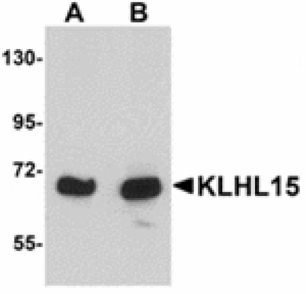 Western blot - KLHL15 Antibody from Signalway Antibody (24914) - Antibodies.com