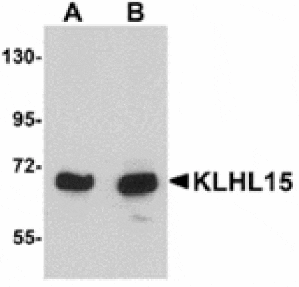 Western blot - KLHL15 Antibody from Signalway Antibody (24914) - Antibodies.com