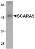 Western blot - SCARA5 Antibody from Signalway Antibody (24930) - Antibodies.com