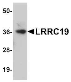 Western blot - LRRC19 Antibody from Signalway Antibody (25072) - Antibodies.com
