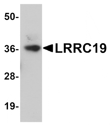 Western blot - LRRC19 Antibody from Signalway Antibody (25072) - Antibodies.com